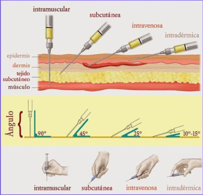 ovinapp te enseña como aplicar una inyección y como manipular o agarra una jeringa