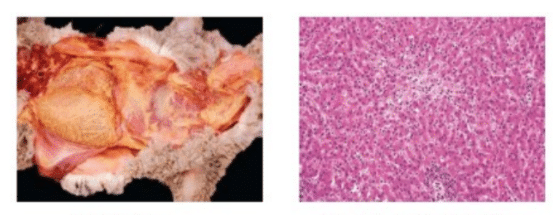 Enterotoxemia in sheep TYPE A
